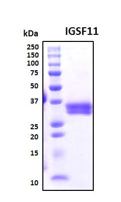 Human IGSF11 / VSIG3 Protein (Recombinant His, N-Terminal)