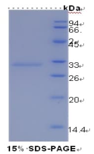 Mouse HAVCR1 / KIM-1 Protein (Recombinant His, N-Terminal)