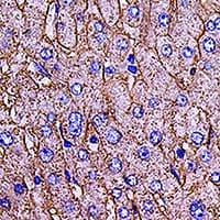 Polyclonal Rabbit anti-Human SLC2A2 / GLUT2 Antibody (IHC, WB)