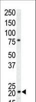 CDKN1A / WAF1 / p21 Antibody (aa134-164)
