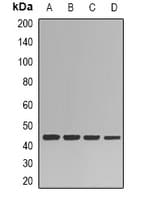 Polyclonal Rabbit anti-Human HPD Antibody (IHC, IF, WB)