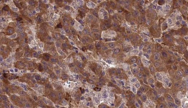 Polyclonal Rabbit anti-Human CDH23 / Cadherin 23 Antibody (IHC, WB)