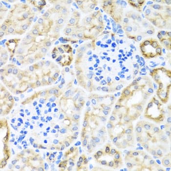 Polyclonal Rabbit anti-Human TIRAP Antibody (IHC, IF, WB)