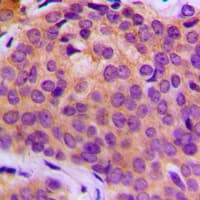 MMP3 Antibody (C-Terminus)