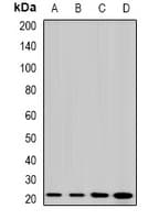 Polyclonal Rabbit anti-Human LIM2 Antibody (WB)