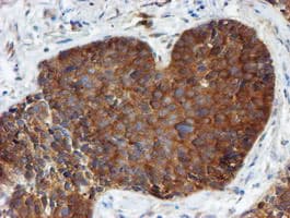 PPAT Antibody (aa42-278, clone OTI1B8)