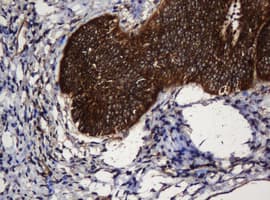 PAI-RBP1 / SERBP1 Antibody (clone OTI5G2)
