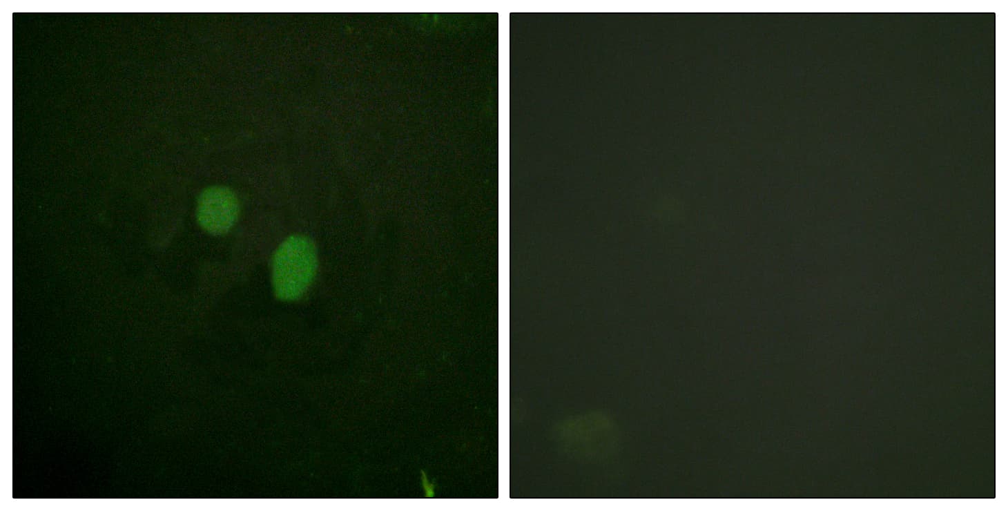 HMGN2 Antibody (aa1-50)