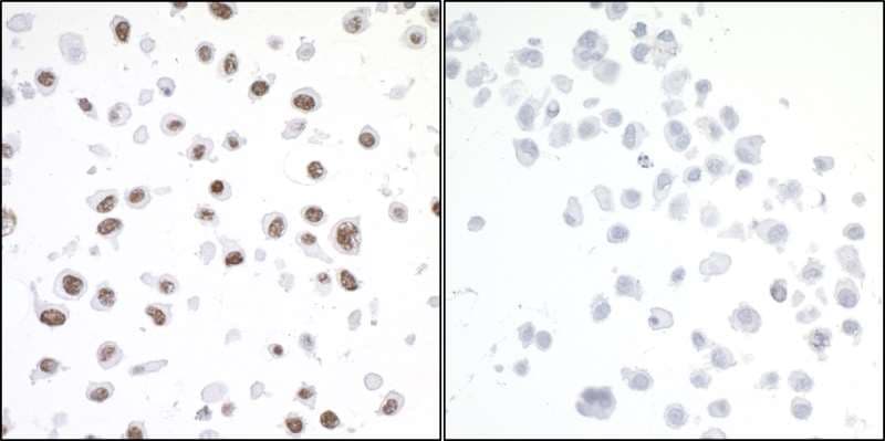 TRIM28 / KAP1 Antibody (phospho-Ser824)