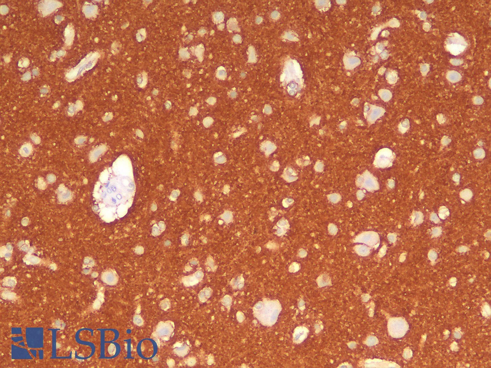 PathPlus™ Recombinant Monoclonal Rabbit anti-Human NCAM / CD56 Antibody (clone NCAM1/2217R, IHC)