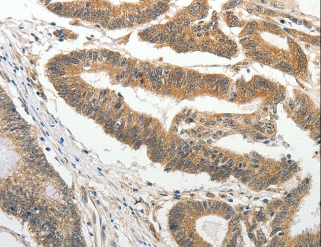 Polyclonal Rabbit anti-Human SLC4A4 / NBC1 Antibody (IHC)