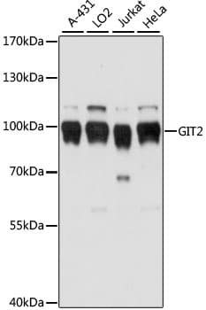 Polyclonal Rabbit anti-Human GIT2 Antibody (WB)
