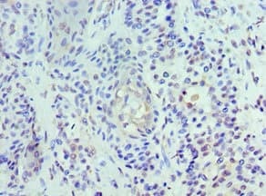 UBC6 / UBE2J2 Antibody (aa1-230)