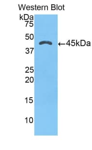 Alpha-1-Antichymotrypsin Antibody (aa235-394, Biotin)