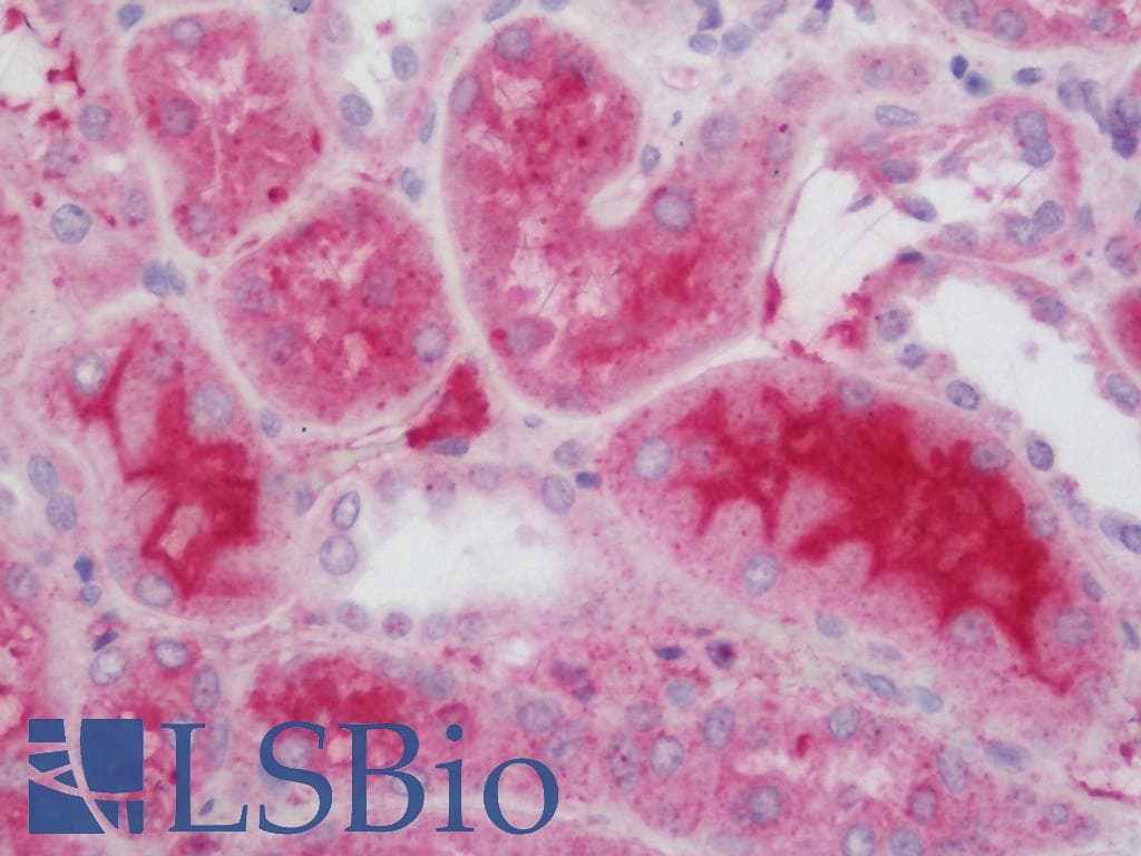 IHC-plus™ Polyclonal Rabbit anti-Human ESCO1 / ECO1 Antibody (aa661-687, IHC, WB)