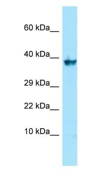 Polyclonal Rabbit anti-Human NPR3 Antibody (C-Terminus, WB)