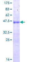 Human SNX20 Protein (Recombinant GST)