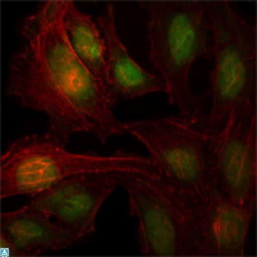 Monoclonal Mouse anti-Human ZBTB7B / HcKrox Antibody (IHC, IF, WB)