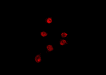 Polyclonal Rabbit anti-Human NRBF2 Antibody (IF, WB)