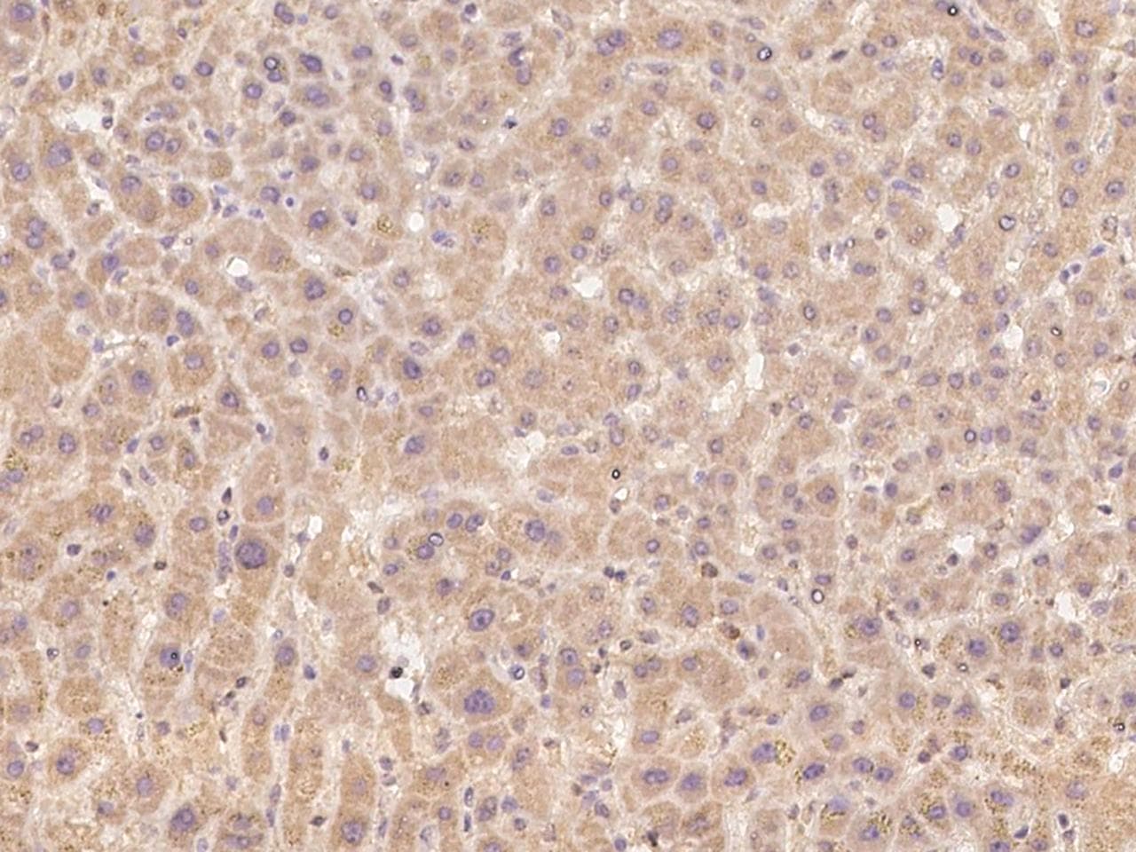 CAPN15 / SOLH Antibody