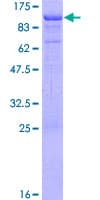 Human DAB1 Protein (Recombinant GST)