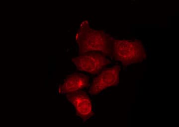 ATG16L2 Antibody