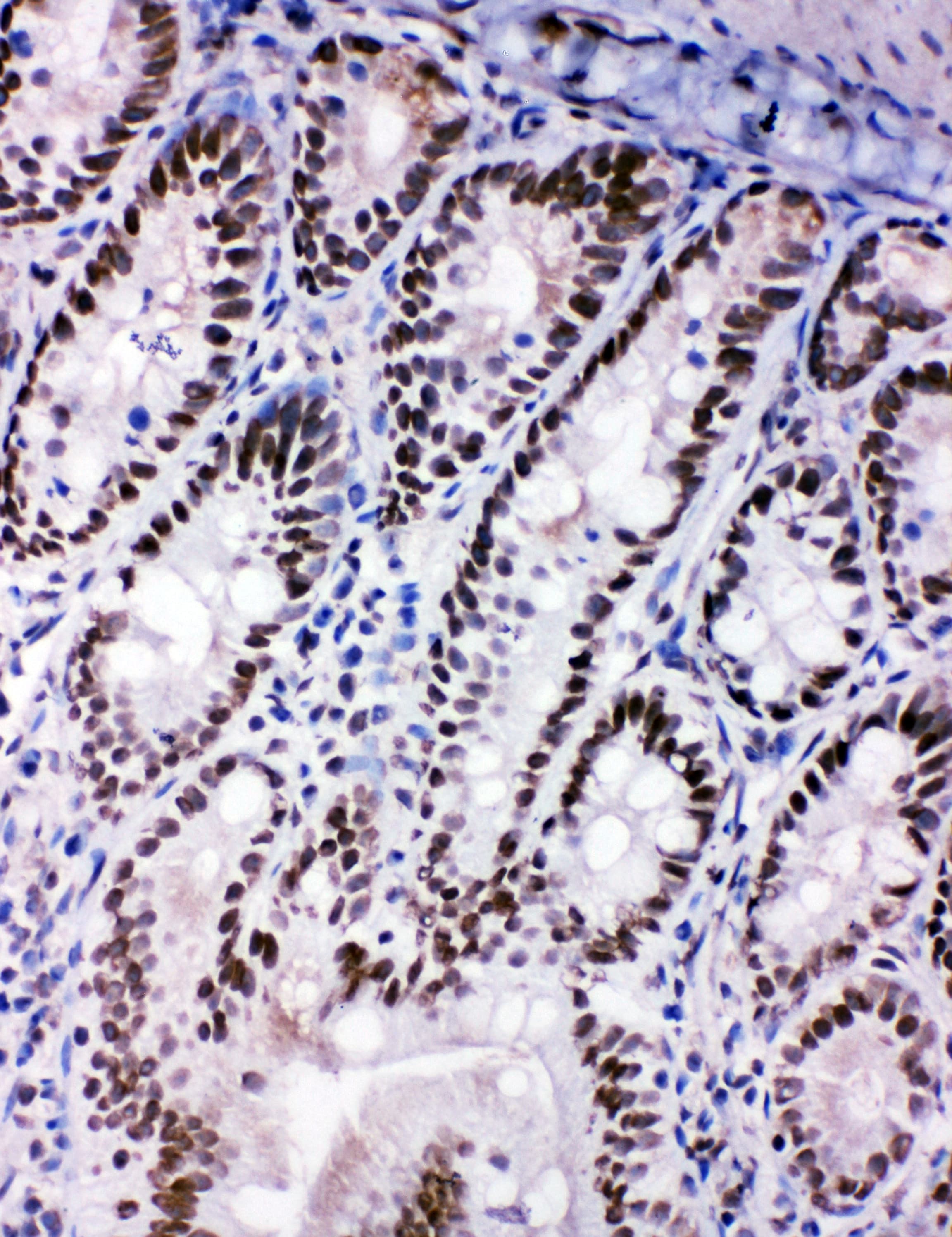 Polyclonal Rabbit anti-Human p66 / SHC Antibody (aa424-440, IHC, WB)