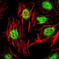 ZBTB16 / PLZF Antibody (clone 5B3)