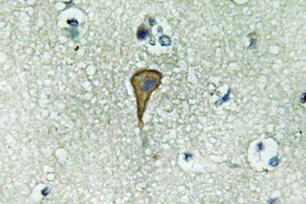 IL20RA Antibody (aa173-222)