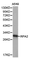 RPA2 / RFA2 / RPA34 Antibody