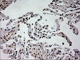 Prominin 2 / PROM2 Antibody (clone OTI6B7)