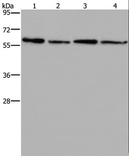 Polyclonal Rabbit anti-Human ART4 Antibody (IHC, WB)