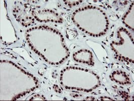 Monoclonal Mouse anti-Human MGLL / Monoacylglycerol Lipase Antibody (clone OTI1B1, IHC, IF, WB)