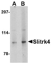 Polyclonal Rabbit anti-Human SLITRK4 Antibody (IHC, IF, WB)