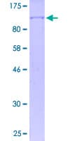 Human LIN41 / TRIM71 Protein (Recombinant GST)