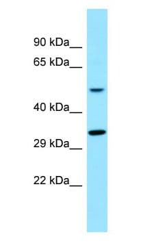 Polyclonal Rabbit anti-Human TAS2R16 / T2R16 Antibody (C-Terminus, WB)