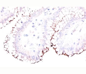 Helicobacter pylori Antibody (Azide-free, BSA-free)