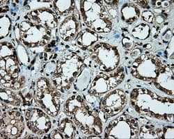 PLEK / Pleckstrin Antibody (clone OTI6H8)