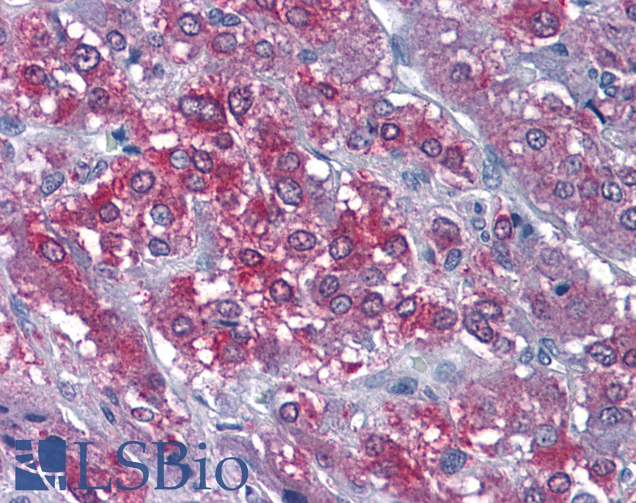 PathPlus™ CAMK2A / CaMKII Alpha Antibody (aa455-468)