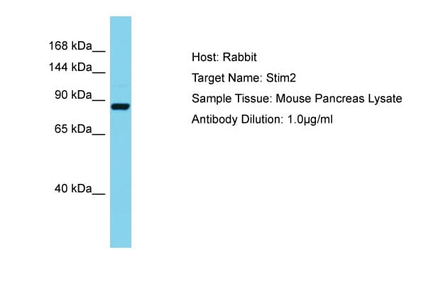 Polyclonal Rabbit anti-Mouse STIM2 Antibody (aa663-712, WB)