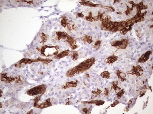 KRT16 / CK16 / Cytokeratin 16 Antibody (clone OTI1G5, Carrier-free)
