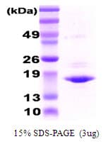 Human CRYAA / Alpha A Crystallin Protein (Recombinant)