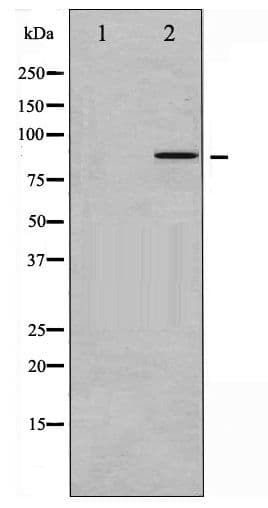 Polyclonal Rabbit anti-Human NR3C1/Glucocorticoid Receptor Antibody (phospho-Ser203, WB)