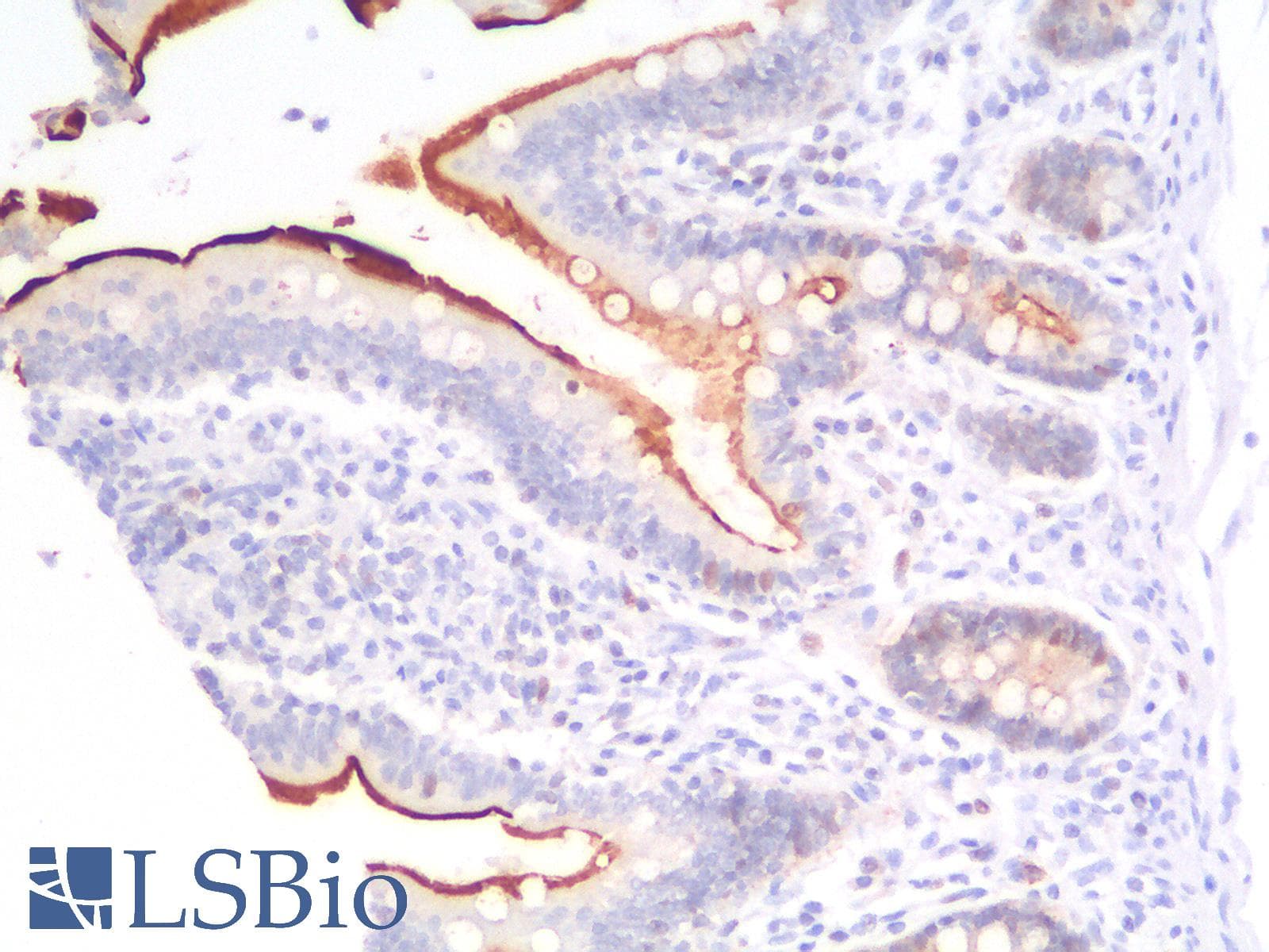 PathPlus™ Recombinant Monoclonal Mouse anti-Human VIL1 / Villin Antibody (clone rVIL1/1325, aa179-311, IHC)