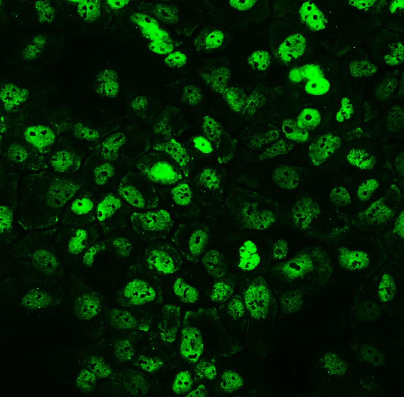 Polyclonal Rabbit anti-Human CCT3 Antibody (IHC, WB)