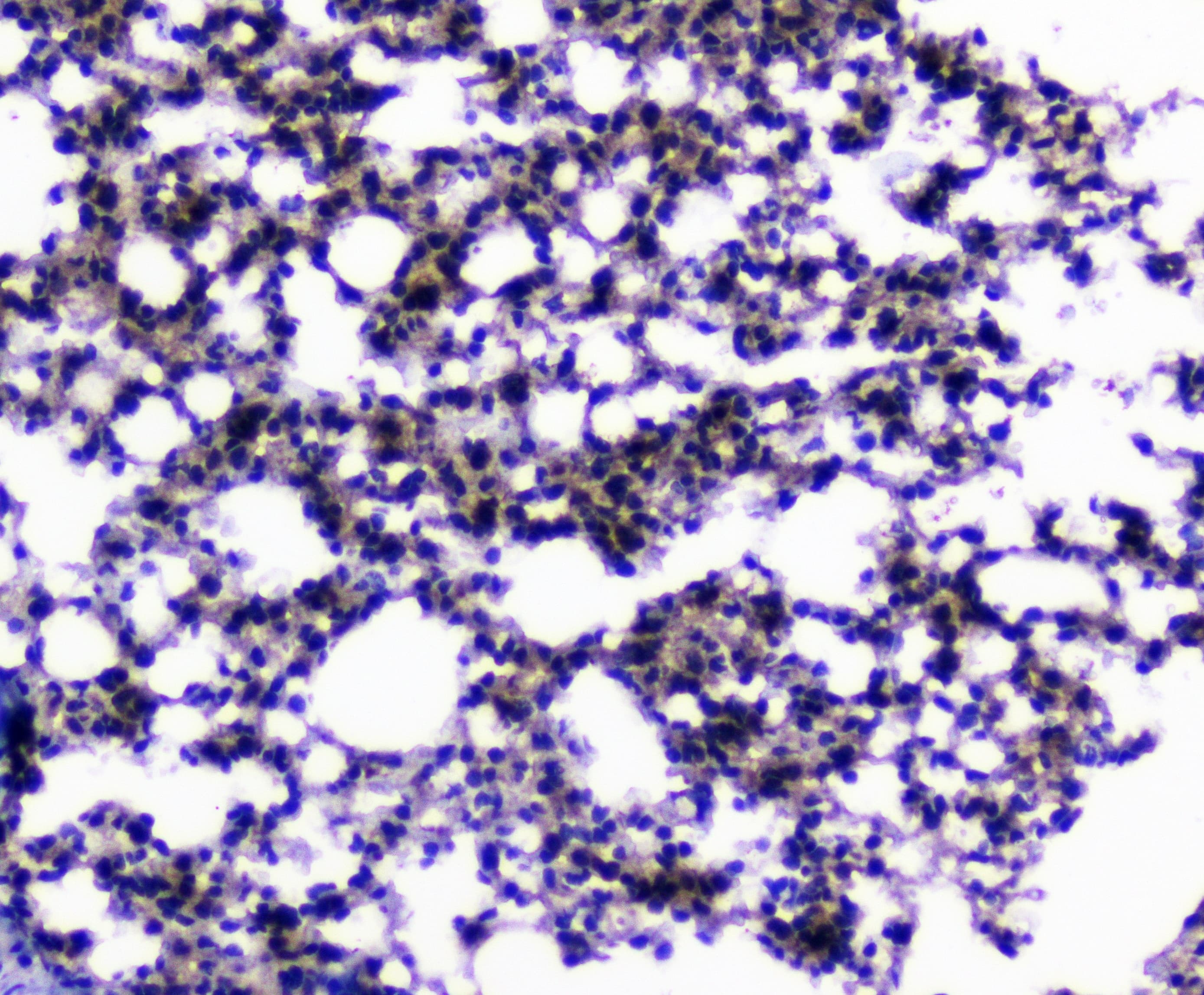 Polyclonal Rabbit anti-Human Capicua / CIC Antibody (IHC)