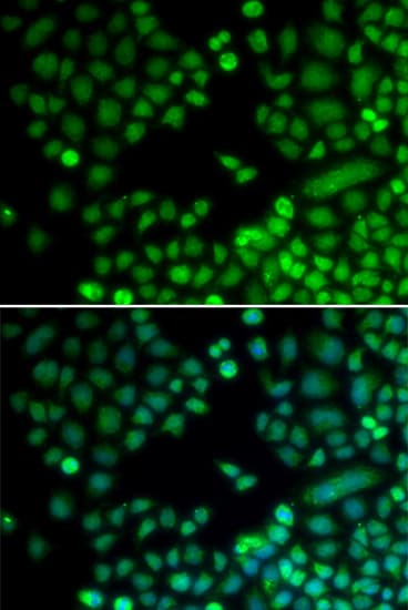 Polyclonal Rabbit anti-Human RAD9A / RAD9 Antibody (IHC, IF, WB)