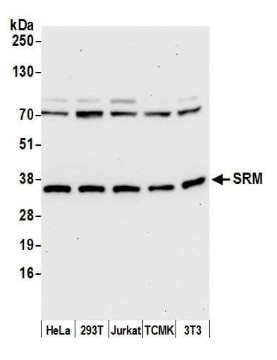 SRM / Spermidine Synthase Antibody (aa252-302)