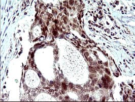 PMS2 Antibody (clone OTI2G5)