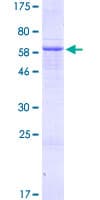 Human ADAT3 Protein (Recombinant GST)